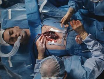 repo-menjude-lawyremyartificial-heart-transplantfi